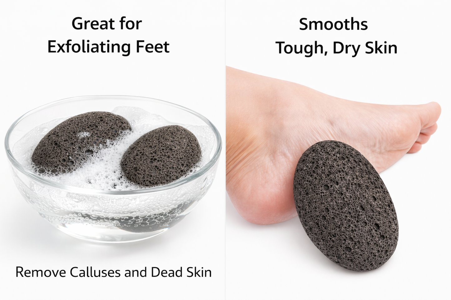 Natural Volcanic Pumice Stone for Feet – Callus Remover & Dead Skin Exfoliating Foot Stone